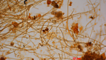 iron oxidizing bacteria